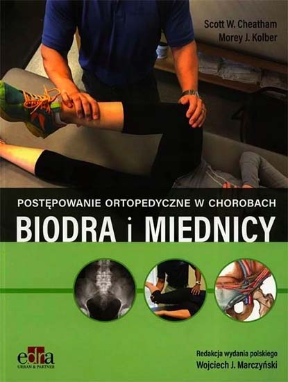 Leczenie ortopedyczne biodra i miednicy