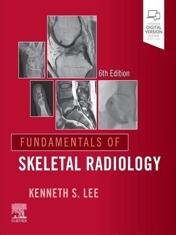 Okładka: Fundamentals of Skeletal Radiology