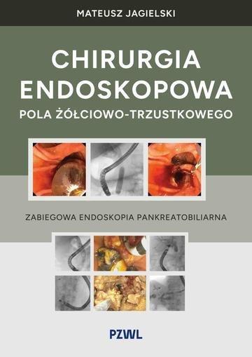 Okładka: Chirurgia endoskopowa pola żółciowo-trzustkowego. Zabiegowa endoskopia pankreatobiliarna