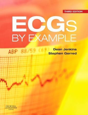 Ecgs By Example