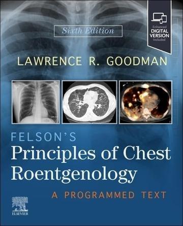 Okładka: Felson's Principles of Chest Roentgenology