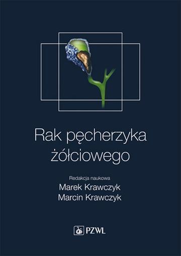 Rak pęcherzyka żółciowego