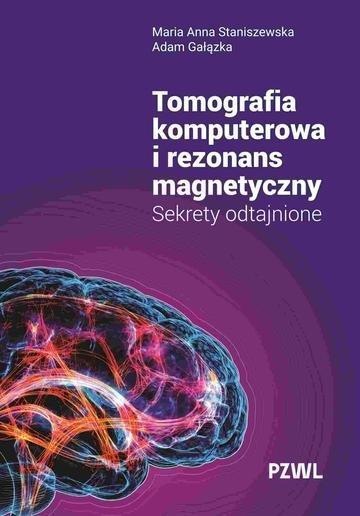 Okładka: Tomografia komputerowa i rezonans magnetyczny. Sekrety odtajnione