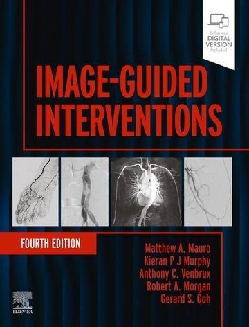 Okładka: Image-Guided Interventions