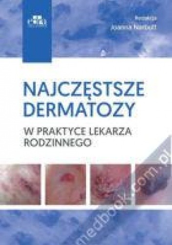 Najczęstsze dermatozy w praktyce lekarza rodzinnego