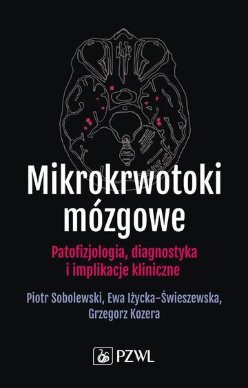 Mikrokrwotoki mózgowe. Patofizjologia, diagnostyka i implikacje kliniczne