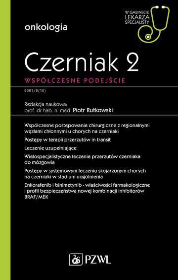 Czerniak. Współczesne podejście 2. W gabinecie lekarza specjalisty. Onkologia