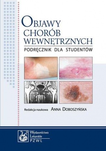 Objawy chorób wewnętrznych. Podręcznik dla studentów