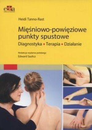 Mięśniowo-powięziowe punkty spustowe