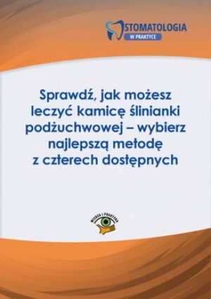 Sprawdź, jak możesz leczyć kamicę ślinianki podżuchwowej - wybierz najlepszą metodę z czterech dostępnych