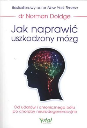 Jak naprawić uszkodzony mózg od udarów i chronicznego bólu po choroby neurodegeneracyjne