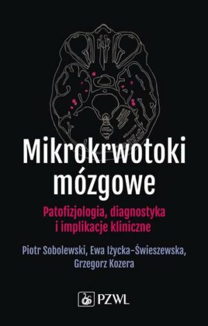 Mikrokrwotoki mózgowe. Patofizjologia, diagnostyka i implikacje kliniczne